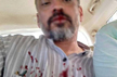Congress workers attack ’No job-No Vote’ campaigner in Mysuru